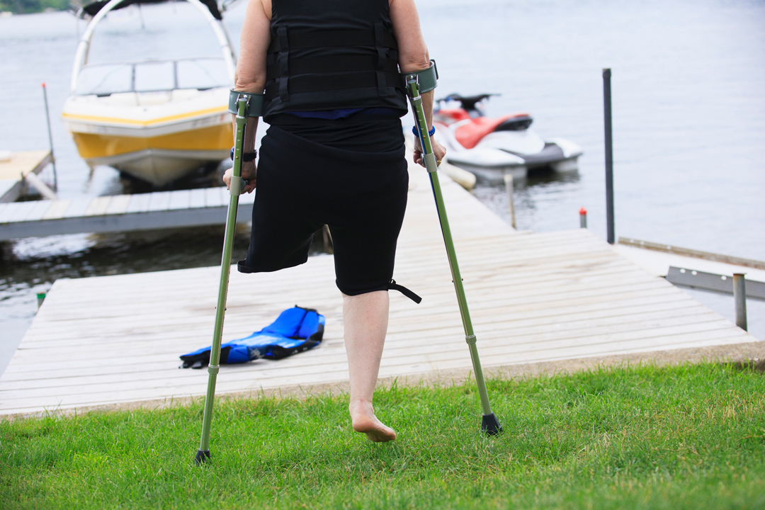 Woman with a missing leg and on crutches with a lake in the background